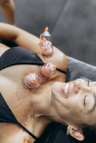 cupping