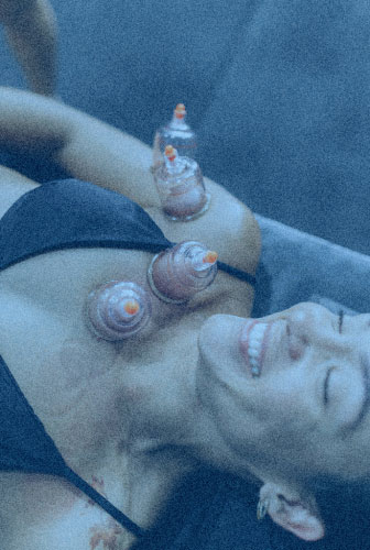 cupping
