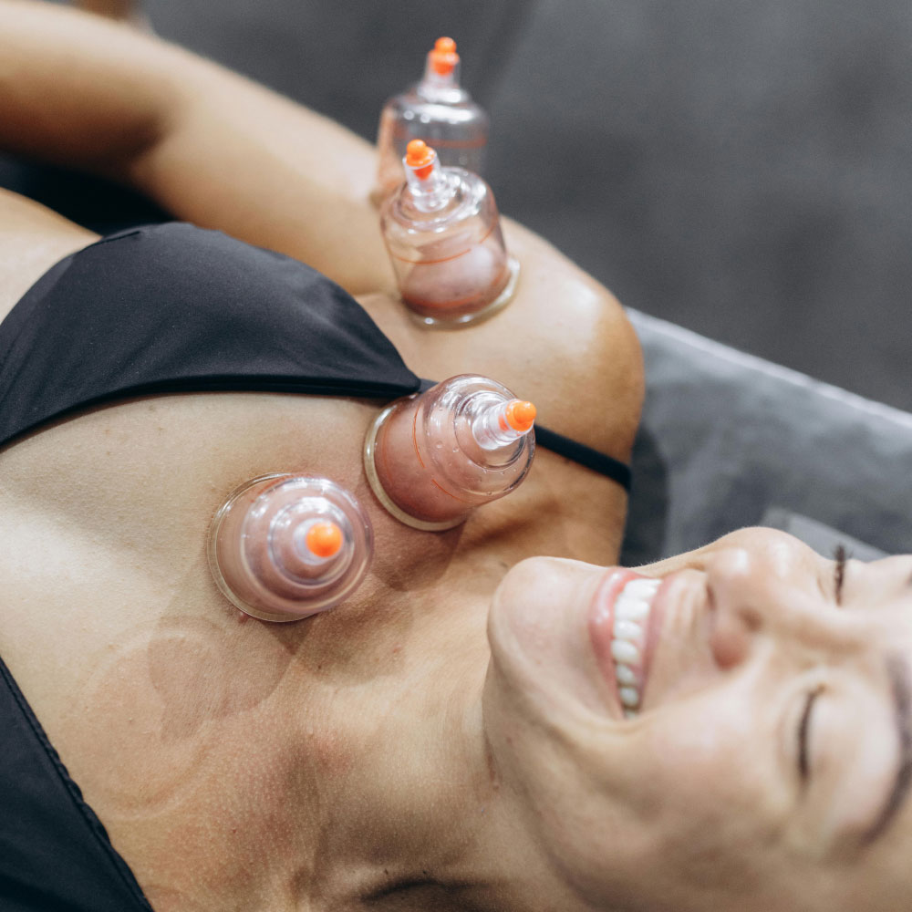cupping